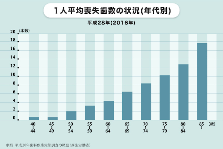 日本人の80％が歯周病です。